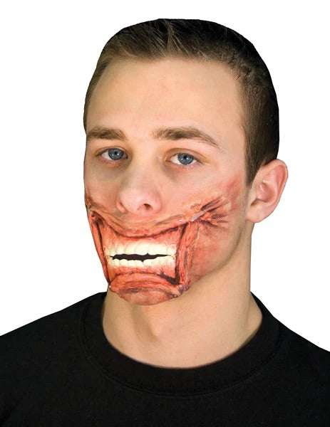 Stapled Mouth
