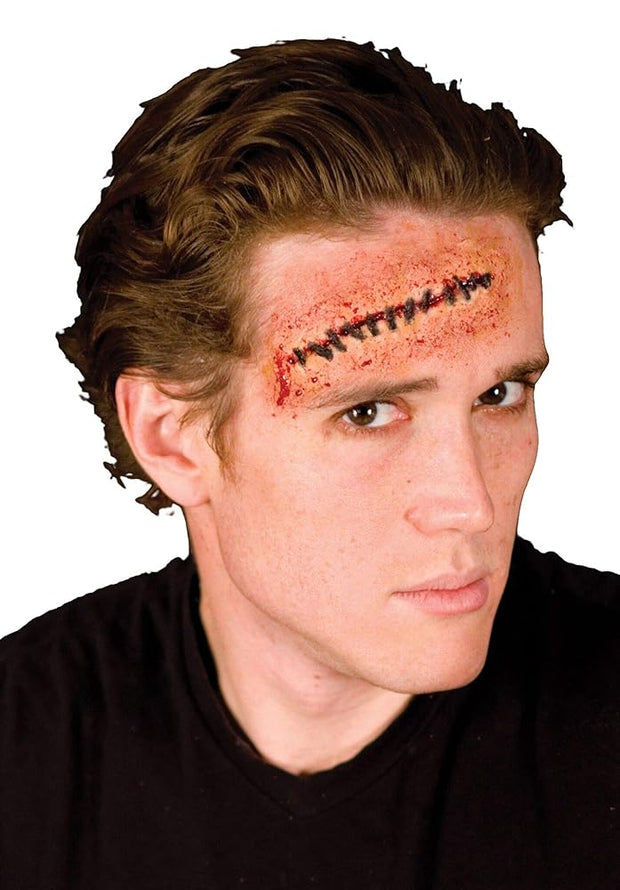 Stitches
