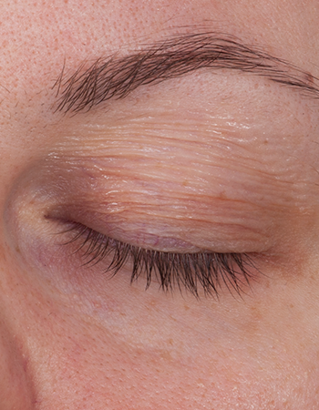 Kryolan Old Skin Plast (DG Class 3) - Kryolan - Minifies Makeup Store