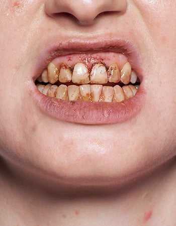 Kryolan Tooth Enamel